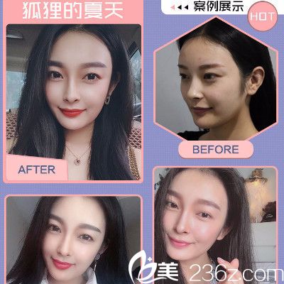 (11月17日)扬子石化乙二醇联合装置高负荷测试【星空·综合体育】(图2) 星空·综合体育